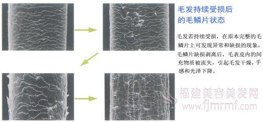 毛发持(chí)续受损(sǔn)后的毛鳞片状态-发质(zhì)与毛发受(shòu)损之关系 毛发持(chí)续受损后的毛鳞片(piàn)状态-发(fā)质与(yǔ)毛发受损之关系